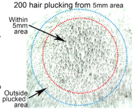 동물실험 결과 어느 빈도 이상으로 털을 뽑을 경우 그 영역에 복구신호가 작동하면서 그 이전에 털이 빠진 모낭에서도 털이 생기면서 주변보다 오히려 털이 더 빽빽해진다. - 셀 제공